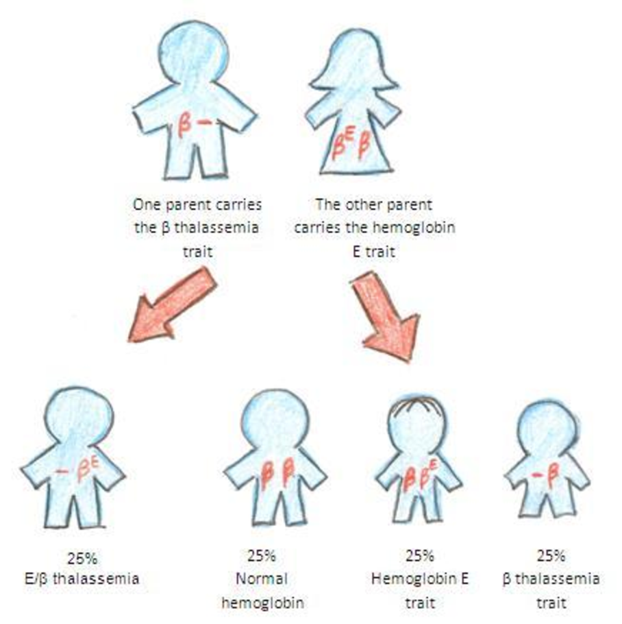 What Is Hemoglobin E Disease StoryMD   Original 