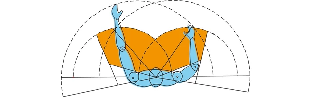 Sciatica - StoryMD