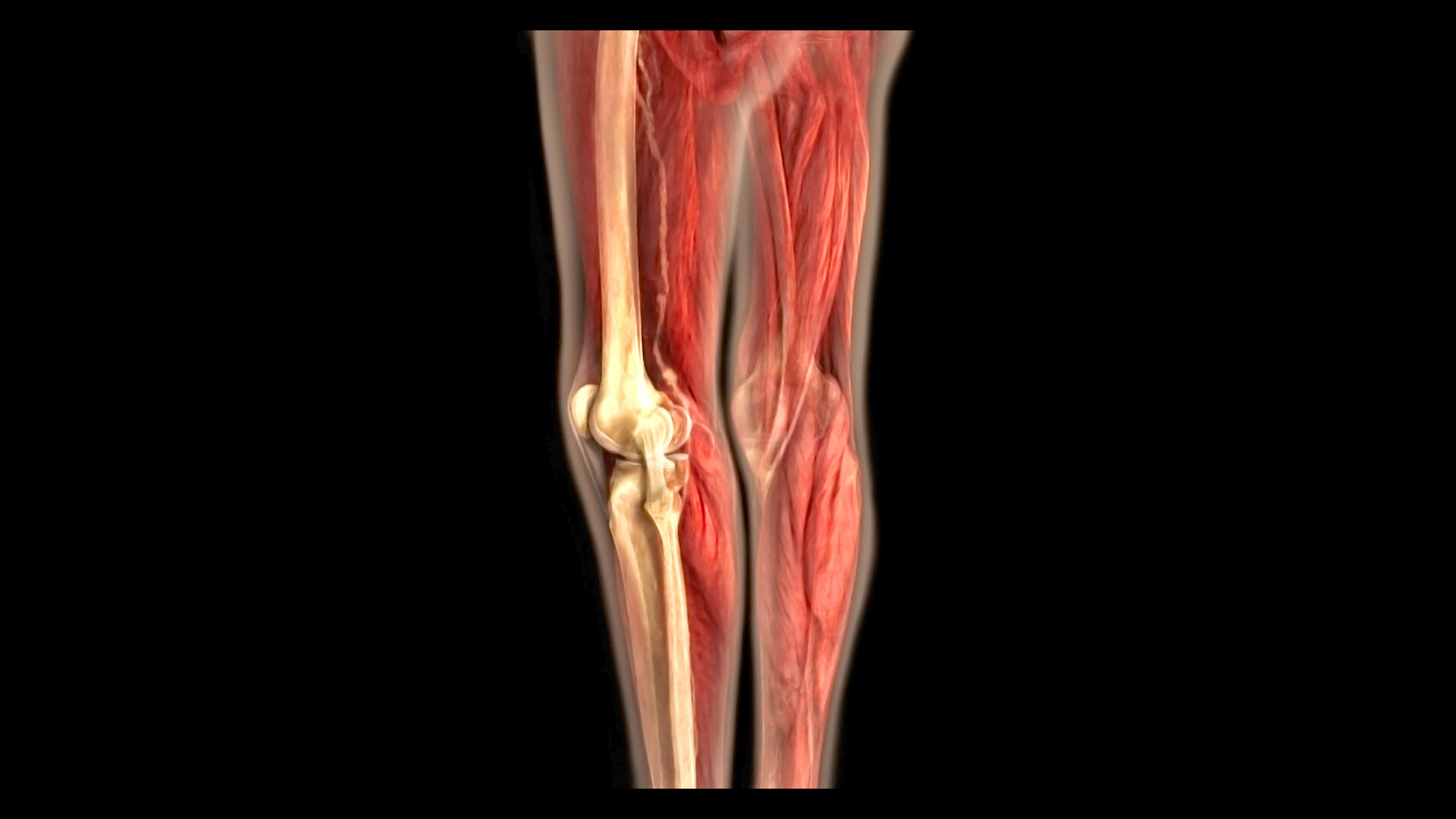 What Is Intermittent Claudication StoryMD What Is Intermittent Claudication StoryMD