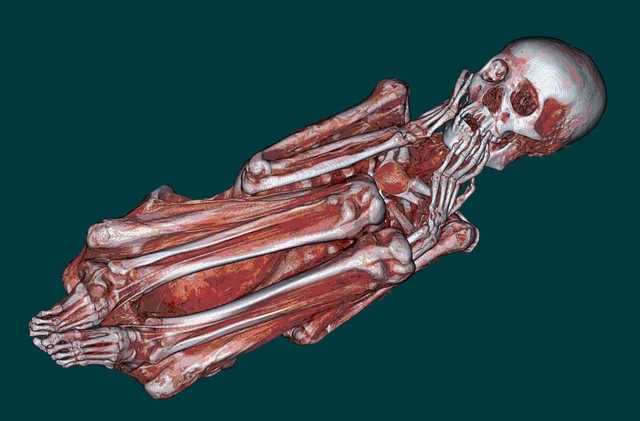 X-Rays - StoryMD