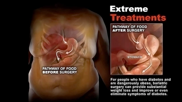 Medication and Invasive Treatment StoryMD