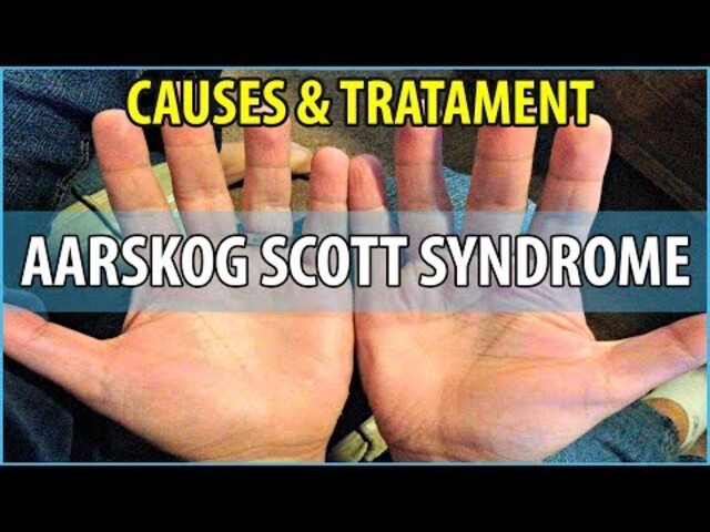aarskog scott syndrome shawl scrotum
