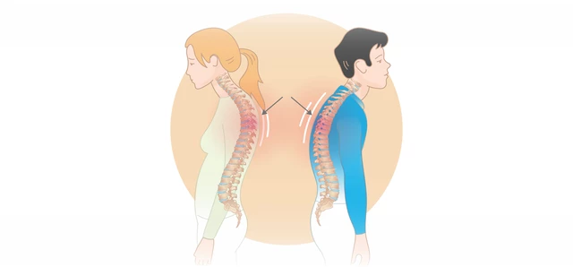 Improve Your Posture for Better Health