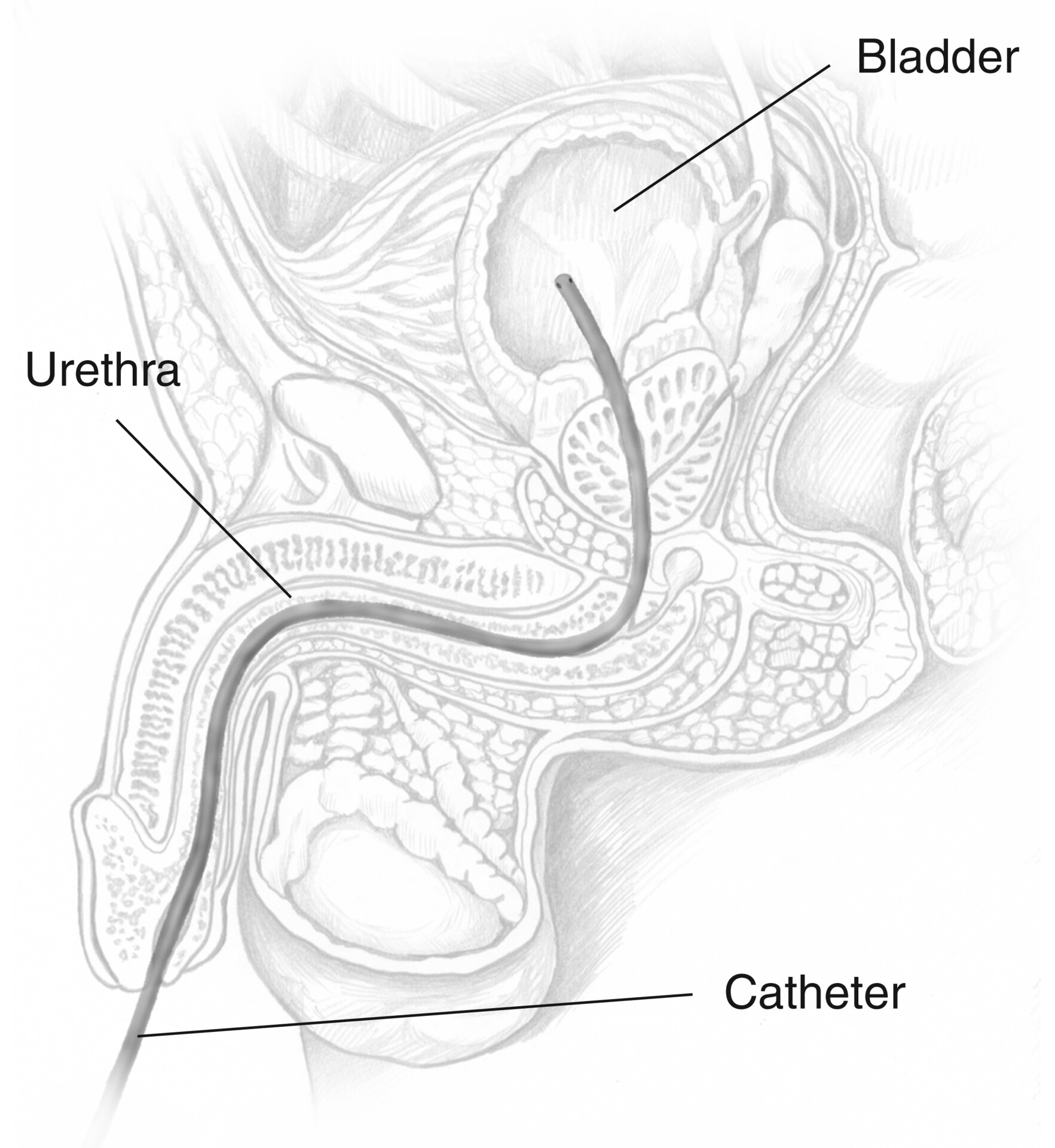 Prevention of Bladder Control Problems (Urinary Incontinence) & Bladder  Health - NIDDK