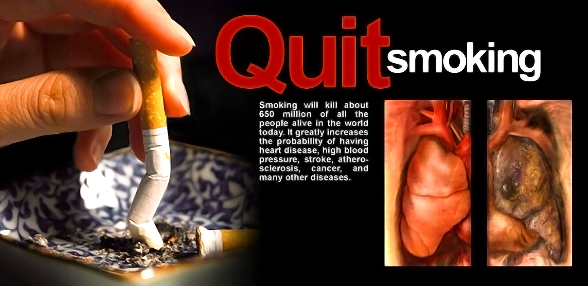 how much for a 20 pack of cigarettes What is a “Pack Year”? — Lung Cancer Kilts Research Cures!